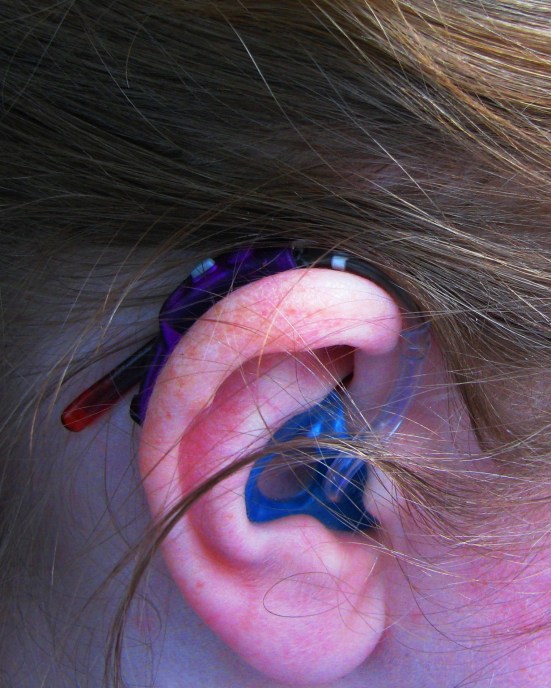 Elizabeth shows off her new 'ear.'