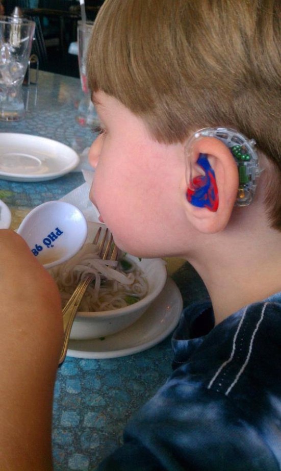 Young Sawyer enjoys dinner while showing off his cool bionic-looking Phonak Versatas and Spidey earmolds. Now that's what I call eating with style!