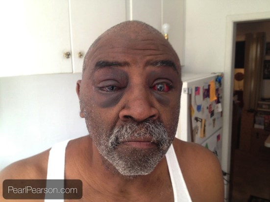 Pearl Pearson, in a photo taken after the assault